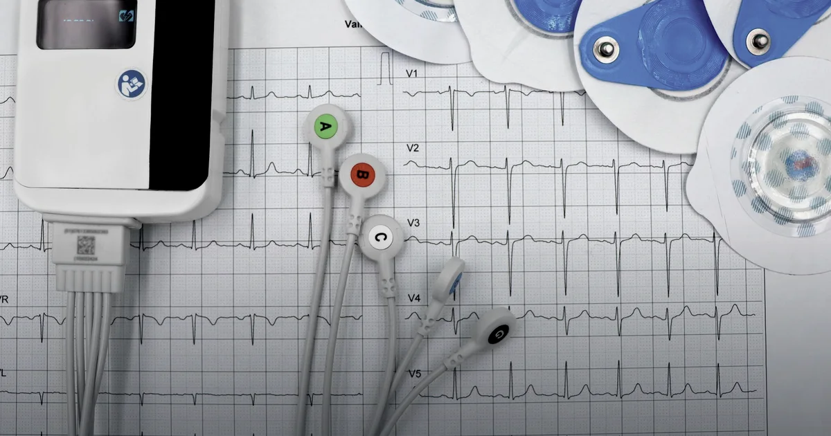 Atrial fibrillation in endurance athletes: it's the volume, not the sport