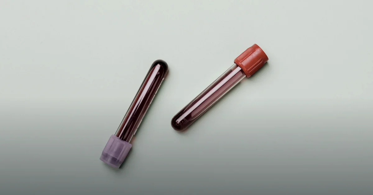 Iron deficiency in female runners: why your pace fades when hemoglobin looks βnormalβ