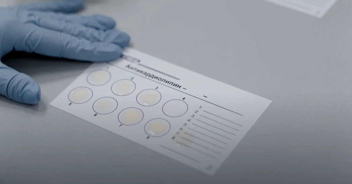 Ketone esters: not race fuel, but an adaptation tool?