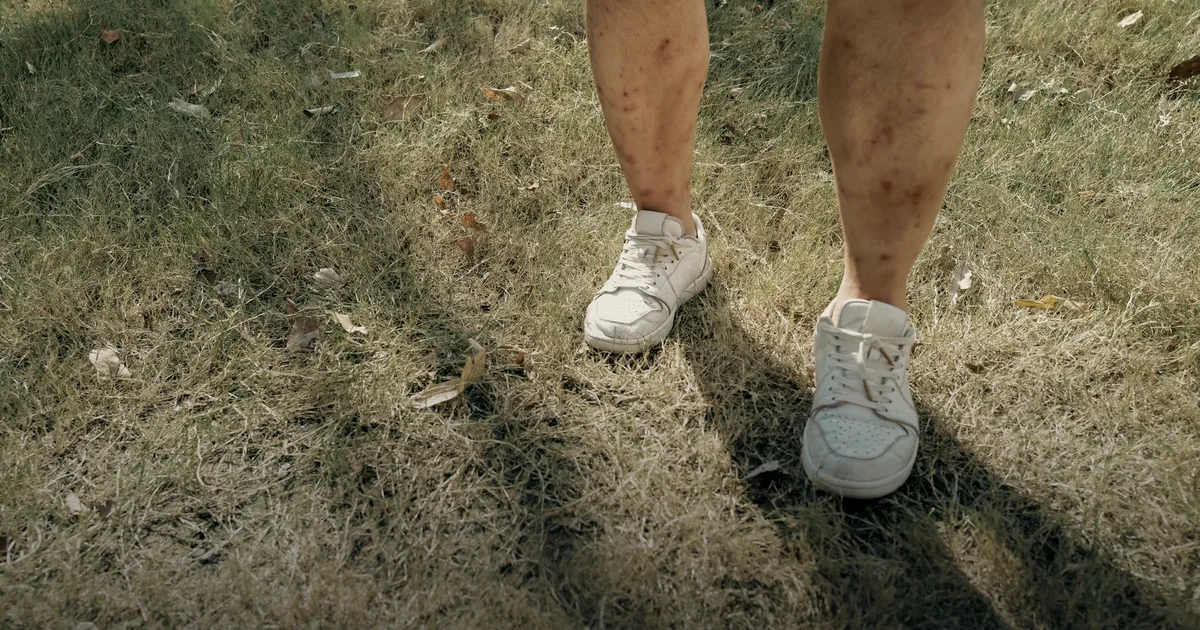 Cramps on Race Day: Why "It Seized Up = You Ran Low on Salt" Is a Myth